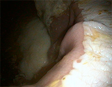 Gastroskopie beim Pferd - Schleimhaut